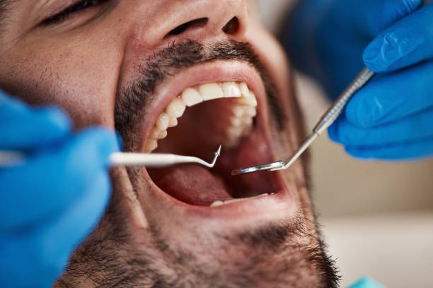 Best Emergency Dental Services for Seniors in Cave City, AR
