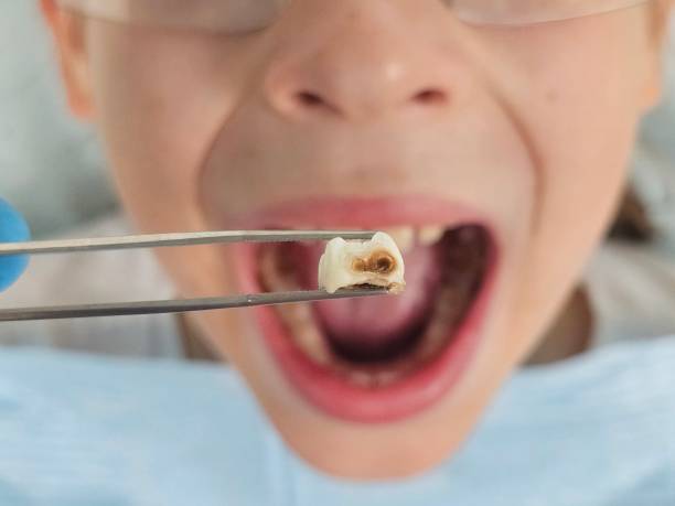 Best Pediatric Emergency Dentist in Cave City, AR