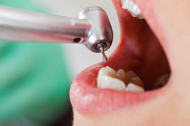 Best Emergency Root Canal Treatment in Cave City, AR